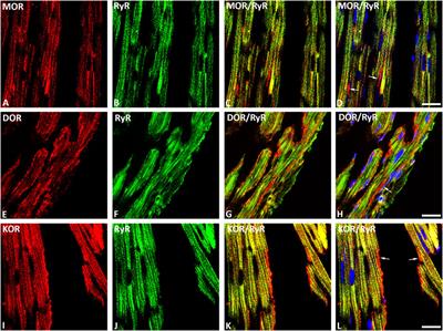 Naltrexone-Induced Cardiac Function Improvement is Associated With an Attenuated Inflammatory Response and Lipid Perioxidation in Volume Overloaded Rats